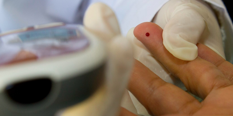 4 entre 10 pacientes com diabetes morrem ao se internar por Covid-19, aponta estudo