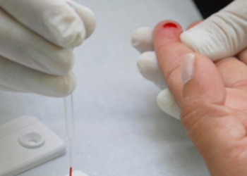 Em 10 anos, RN registra aumento em casos de HIV e AIDS