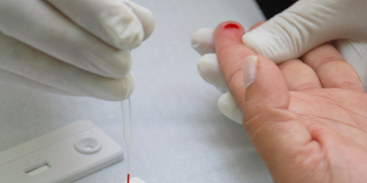 Em 10 anos, RN registra aumento em casos de HIV e AIDS