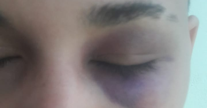 Mulher agredida no Pingo da Mei Dia em Mossoró diz que a única explicação é homofobia