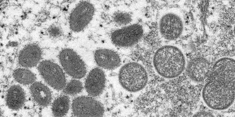 Brasil já confirmou mais de 200 casos de varíola dos macacos