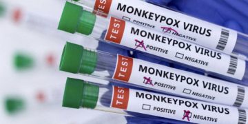 Segundo caso da varíola dos macacos é confirmado no RN