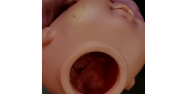 Polícia encontra droga escondida em boneca de criança em Assú