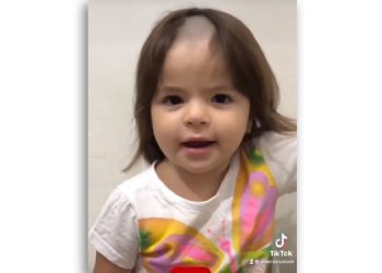 Menina de 2 anos raspa cabelo escondida dos pais e viraliza na internet