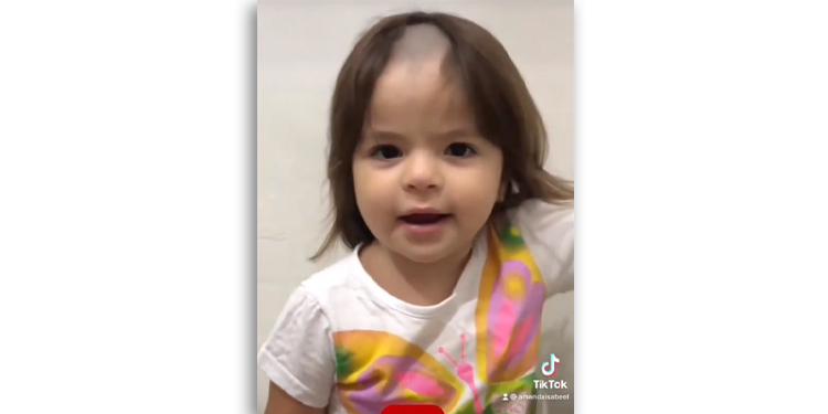 Menina de 2 anos raspa cabelo escondida dos pais e viraliza na internet