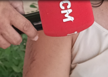 Homem que atropelou ex-esposa em Mossoró é denunciado por tentativa de homicídio e de feminicídio