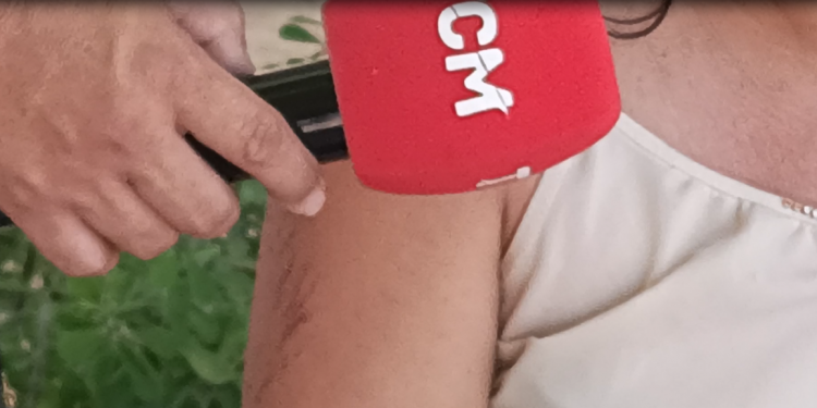 Mulher vítima de atropelamento e pedradas pelo ex-companheiro diz que tem medo de ser morta