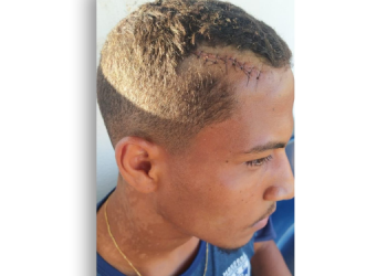 Volante do MEC pegou oito pontos na cabeça em jogo contra o Alecrim