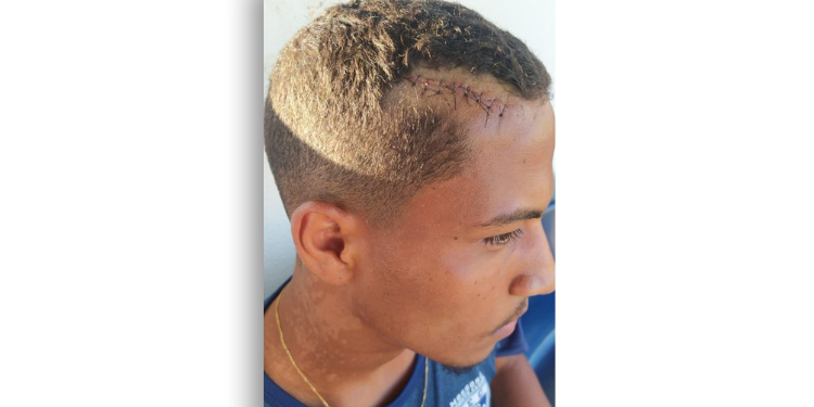 Volante do MEC pegou oito pontos na cabeça em jogo contra o Alecrim