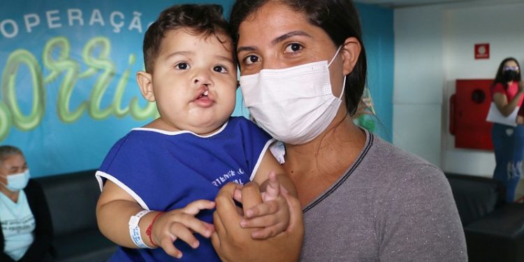 Cirurgias de lábios leporinos começam a ser realizadas nesta quarta