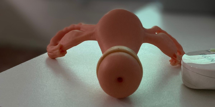 Com alta procura, Faculdade de Enfermagem e Hospital da Mulher realizam mutirão de colocação de DIU