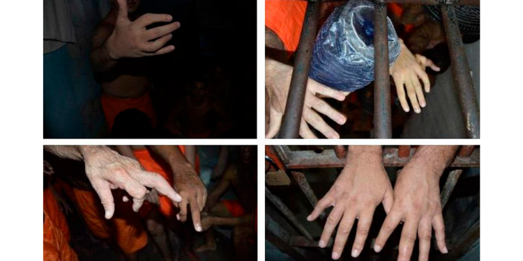 Órgão identifica técnica de fraturar dedos usada para torturar presos do RN