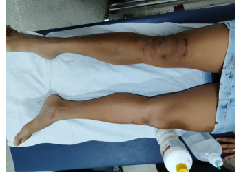 Mulher é agredida por possível dívida do filho em Assú