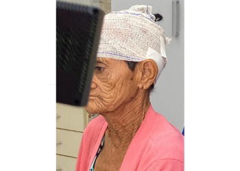 Idosa de 76 anos é agredida a pedrada no Dom Jaime Câmara em Mossoró