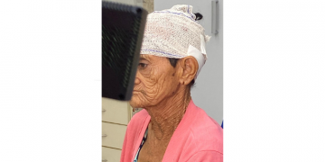 Idosa de 76 anos é agredida a pedrada no Dom Jaime Câmara em Mossoró