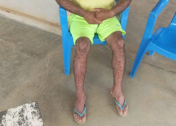 “Eles me deram um tapa”, diz funcionário que foi agredido pelos fugitivos da Penitenciária Federal