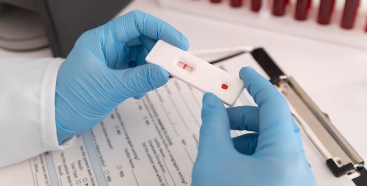 II Ursap e Saúde Prisional realizam testes rápidos de ISTs no Centro de Detenção Provisória de Apodi