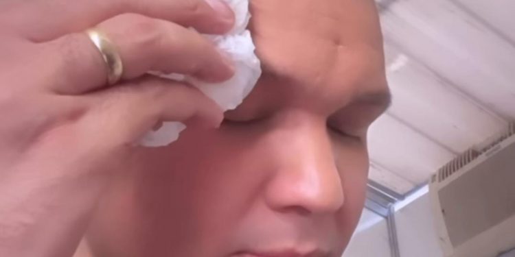 Cantor de Bonde do Brasil se irrita ao ser atingido por celular durante show no RN