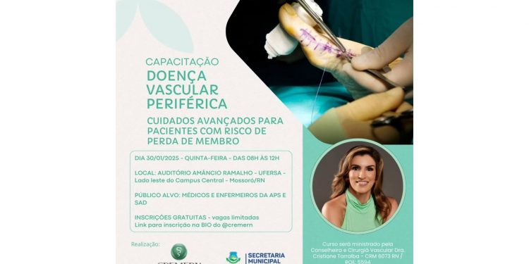 Capacitação sobre doenças vasculares para médicos e enfermeiros será realizada na Ufersa