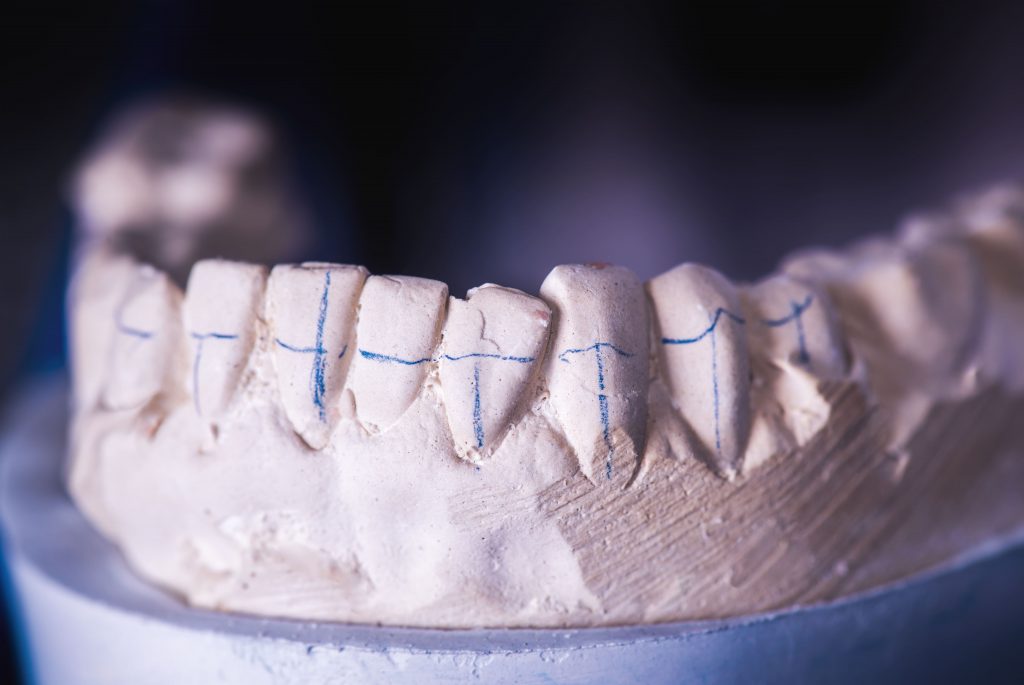 Anormalidade nos dentes, se diagnosticada de maneira precoce, pode trazer qualidade de vida para o ser humano.