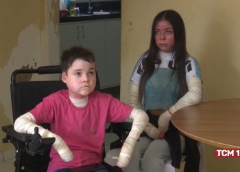 Irmãos com epidermólise bolhosa necessitam de doações