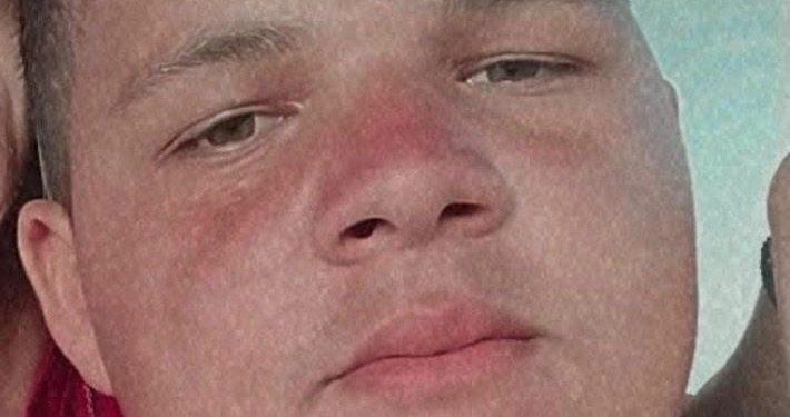 Jovem é morto a tiros em Governador Dix-sept Rosado