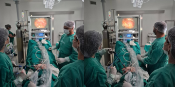 Hospital da Mulher realiza primeira cirurgia de endometriose por videolaparoscopia pelo SUS
