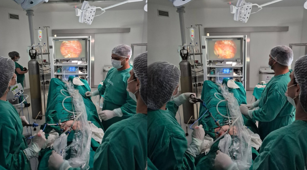 Hospital da Mulher realiza primeira cirurgia de endometriose por videolaparoscopia pelo SUS