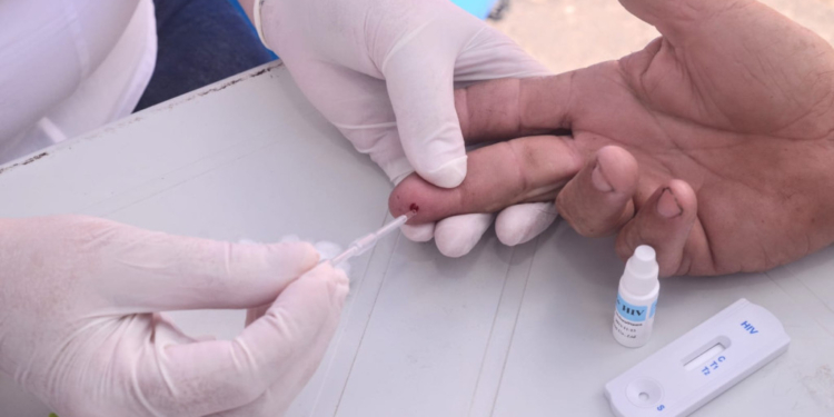 Prefeitura de Mossoró realiza blitz de prevenção às ISTs no Carnaval nesta sexta (13)