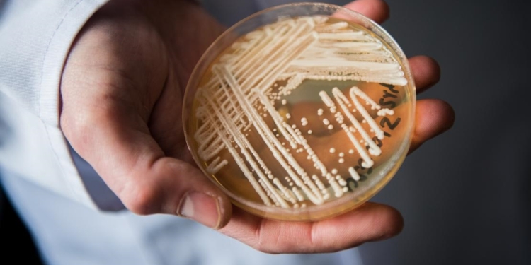 Sesap confirma novo caso de “superfungo” em hospital de Natal